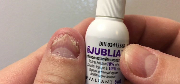 order cheaper jublia online in Loghill Village, CO